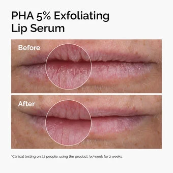 PHA 5% Exfoliating Lip Serum - Image 2