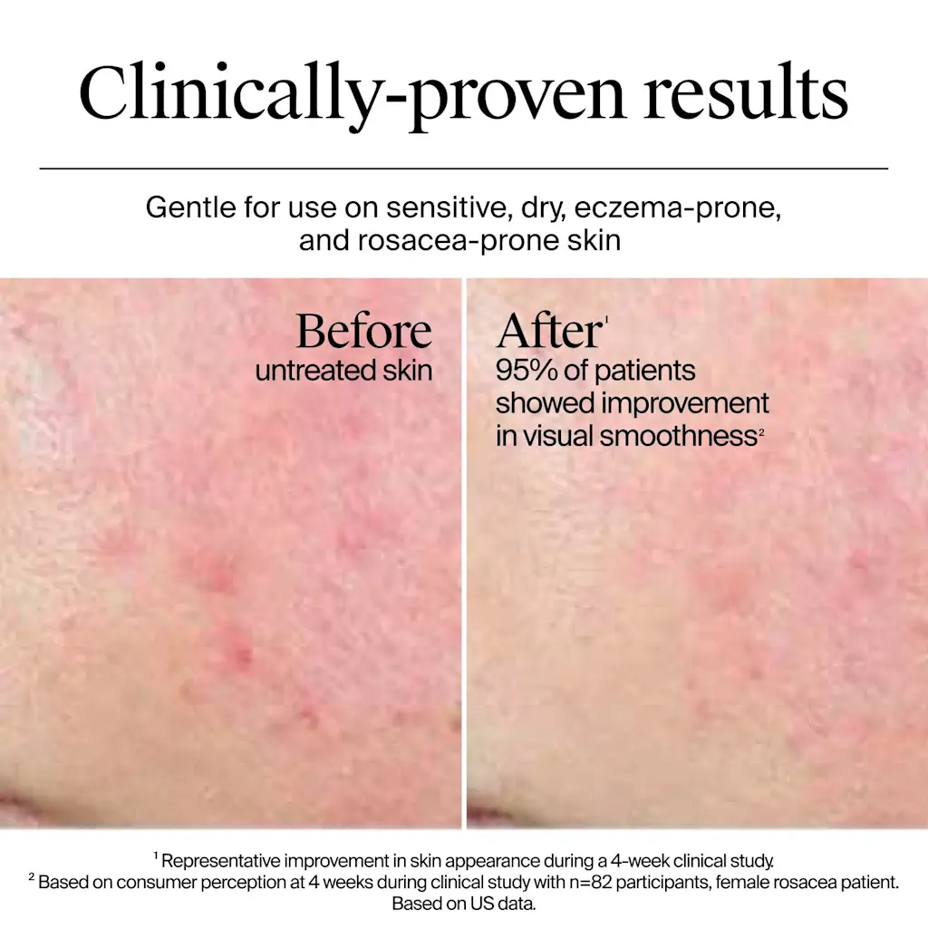 Neutrogena® Hydro Boost Gel Cream Extra-Dry - Image 9